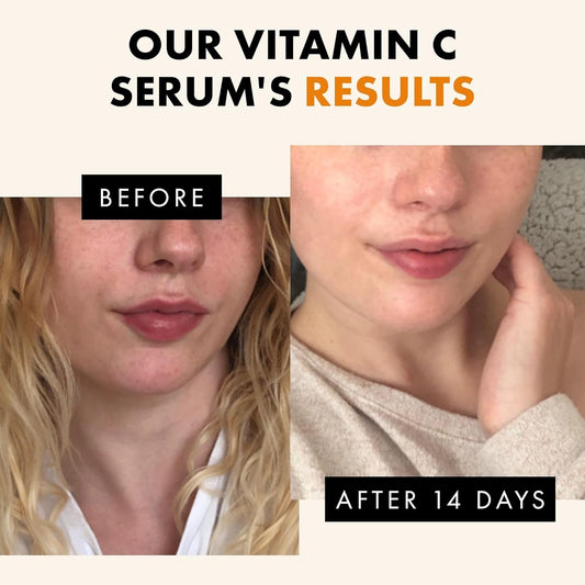 Top 3 Benefits of Using Eclat Vitamin C Brightening & Anti-Aging Facial Serum