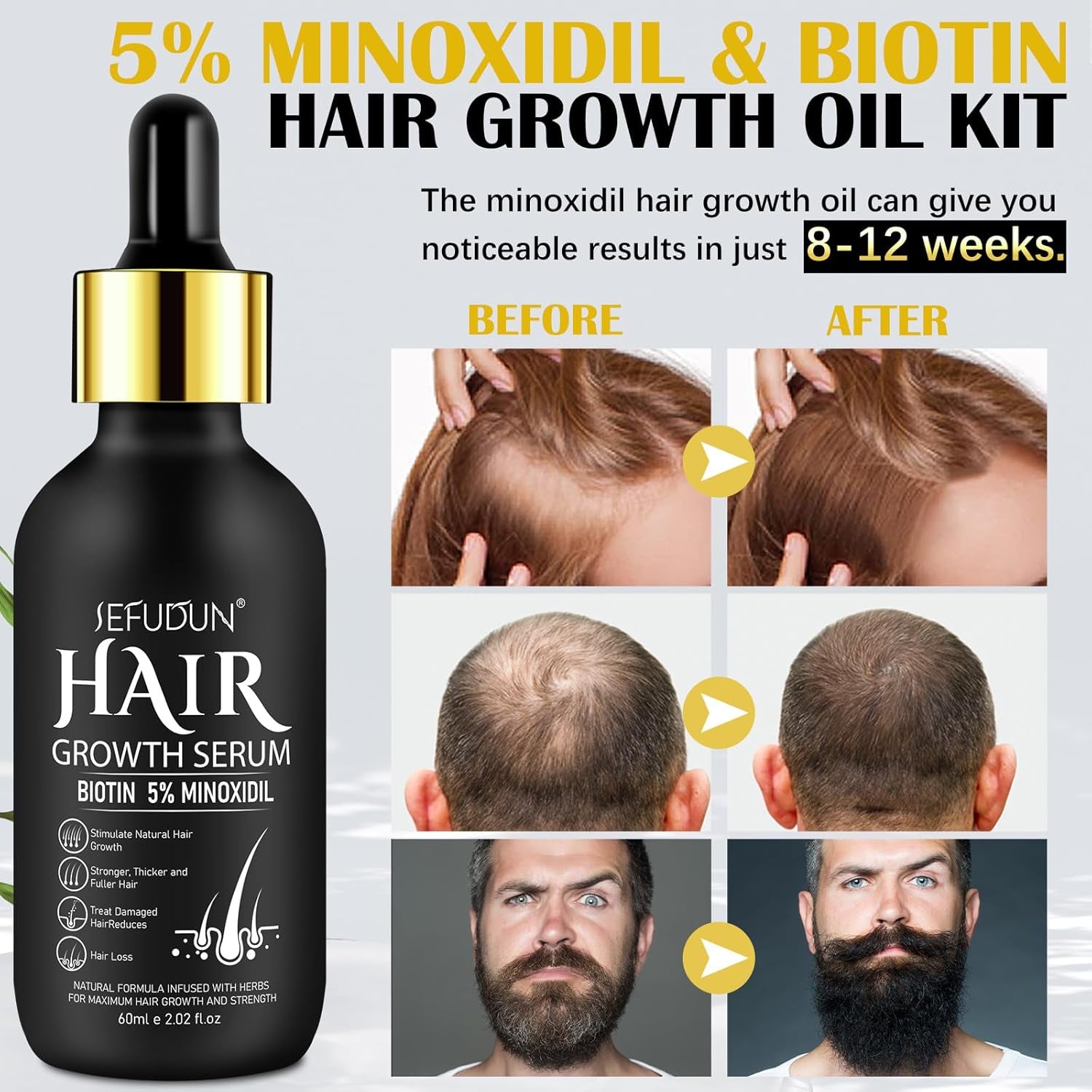 Extra Strength 5% Minoxidil Hair Growth Oil - Regrowth Serum for Men & Women | Topical Treatment Spray for Hair Loss, Thicker Hair & Beard Growth Kit (2.02 Oz)